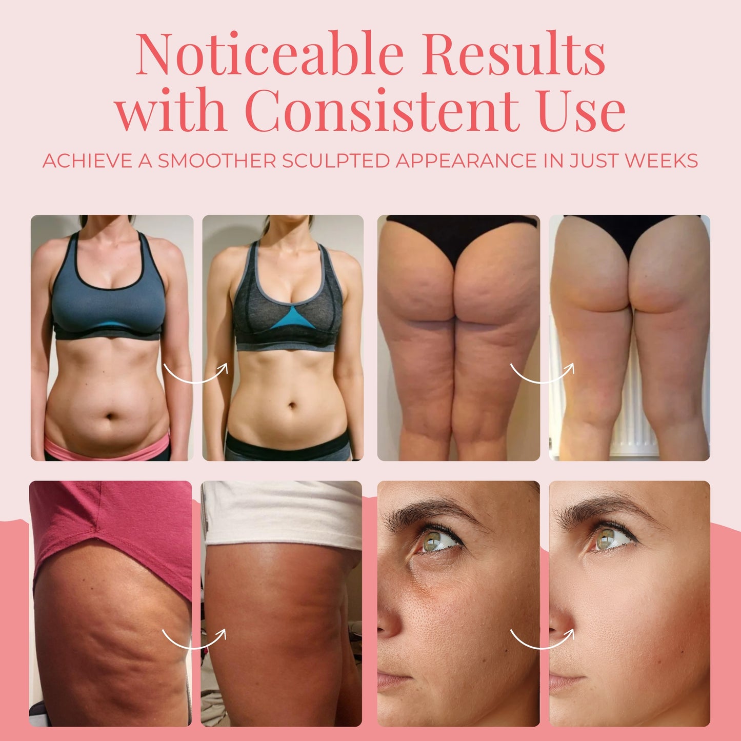 Trimly 3 in 1 Anti-Celullite Body Sculp+